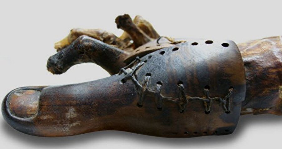 Ayak parmağı
MÖ 950 ve 710 yıllarından kalma olduğu belirlenen protez ayak parmağı.