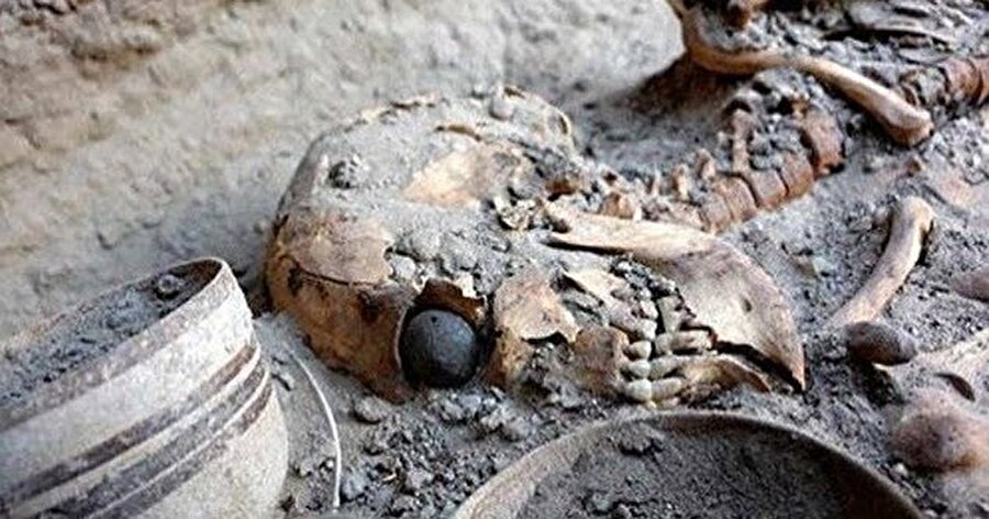 Protez göz
Arkeologlar, 1998 yılında İran ve Afganistan arasında kalan Sistan Bölgesi'nde dünyanın en eski protez gözünü buldu. Gözün 5000 yıl önceye ait olduğu saptandı. 