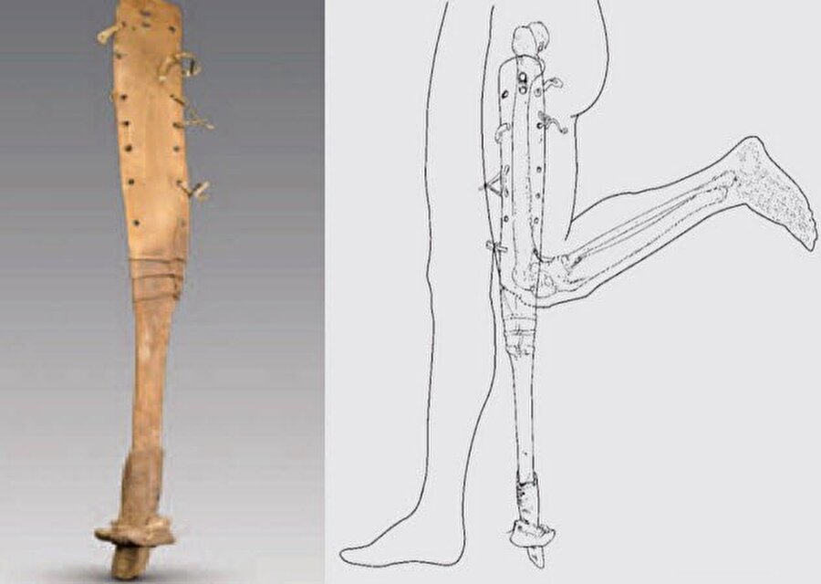 Protez bacak
2007 yılında yapılan bir araştırma sırasında arkeologlar Çin'de 2200 yıllık bir protez buldu. 