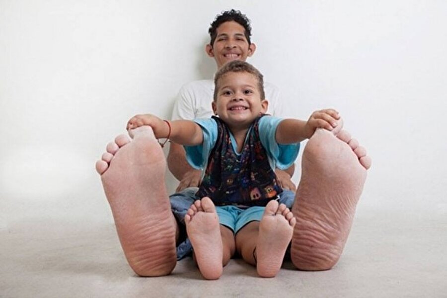 Orlando Jeison Rodriguez Hernandez
En büyük ayaklar... Genç adamın sağ ayağı 40.1 cm, sol ayağı ise 39.6 cm boyunda. (Fotoğraftaki yeğeni)