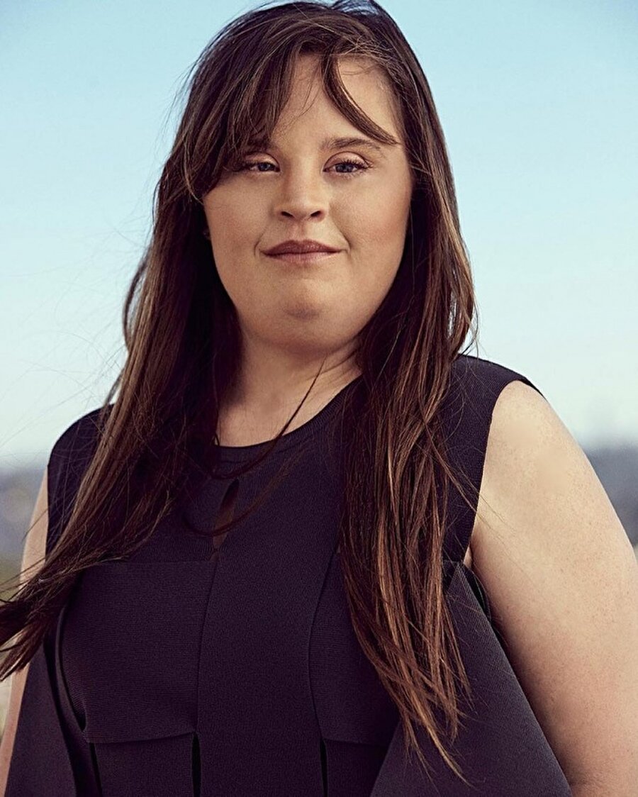 Jamie Brewer
Down sendromlu Jamie Brewer ünlü bir oyuncu ve model.