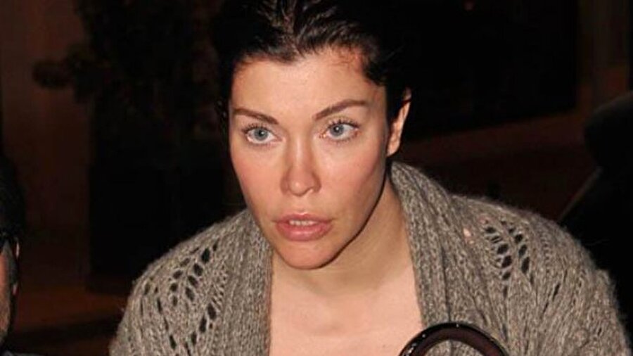 Sosyal medyadan duyurdu

                                    Deniz Akkaya, sağlık durumunu ve yaşadığı talihsiz kazayı Instagram hesabında paylaştığı fotoğrafla duyurdu.
                                