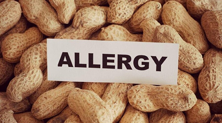 Fıstık alerjisi
Ülkemizde pek görülmese de Avrupa ve Amerika kıtalarında oldukça görülüyor. Fıstık alerjisi üzerinde bilim insanları araştırmalarını sürdürüyor ancak henüz bir açıklama getirebilmiş değiller.