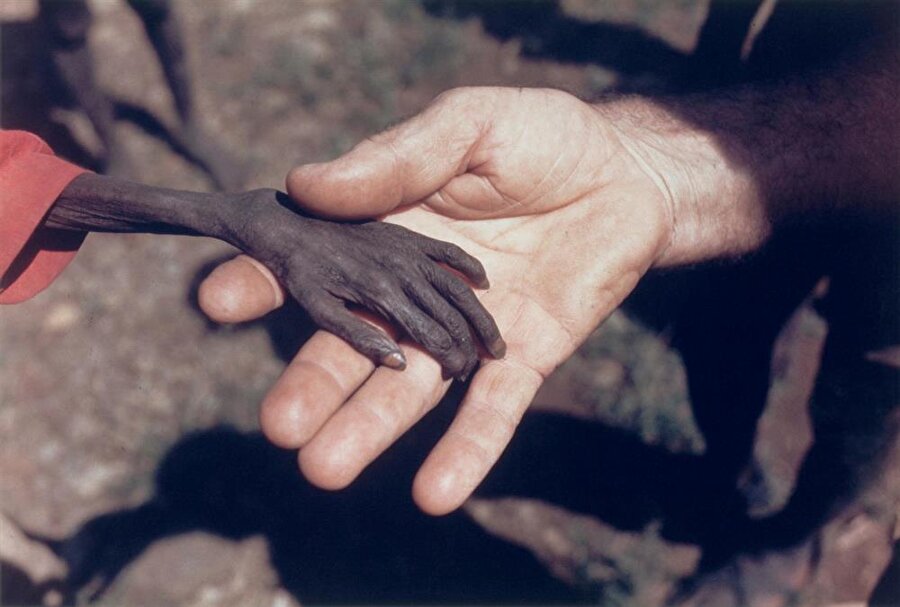 1980
İngiliz fotoğrafçı Mike Wells, kuraklıktan nüfusunun %20'sini kaybeden Uganda'da açlıkla mücadele eden bir çocuğun ve bir yardım gönüllüsünün ellerini çektiği bu fotoğrafla ödülü kazandı.