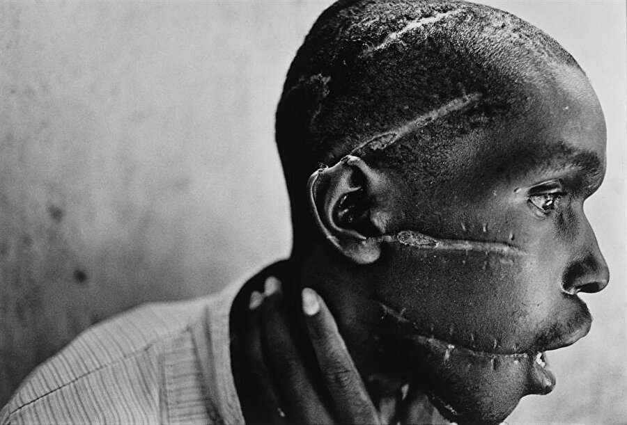 1994
Günümüzün başarılı savaş fotoğrafçılarından birisi olarak kabul edilen ve hakkında “War Photographer” isimli bir belgesel de yapılmış olan James Nachtwey, Ruanda iç savaşında çektiği bu fotoğrafla World Press Photo'unun sahibi oldu.