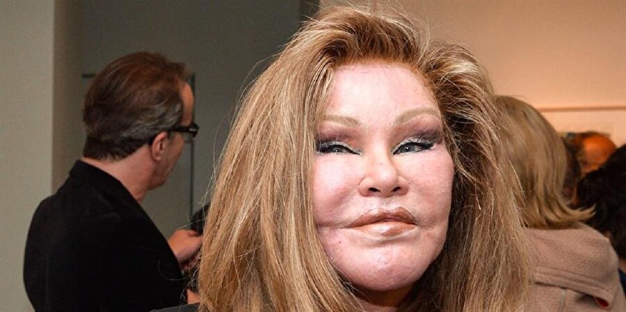 Jocelyn Wildenstein