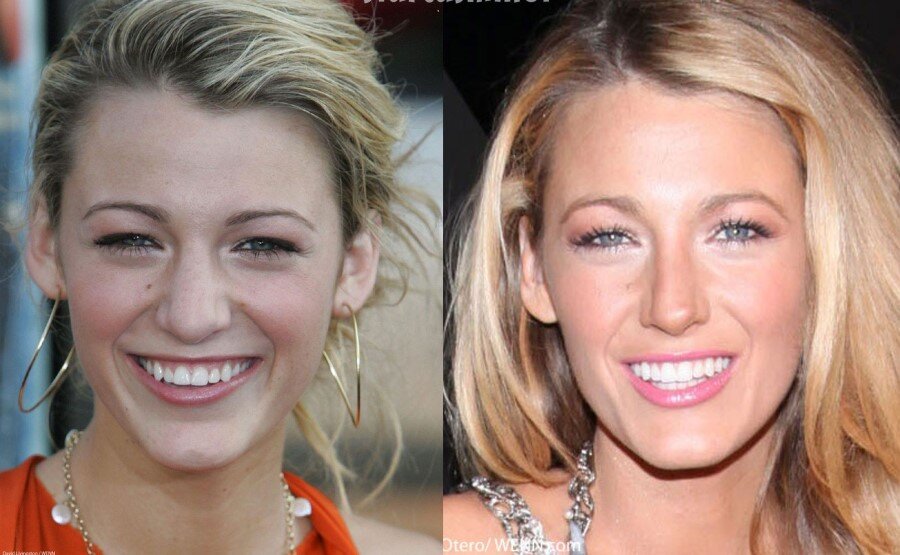 Blake Lively / 7,300 dolar

                                    
                                    
                                    
                                
                                
                                