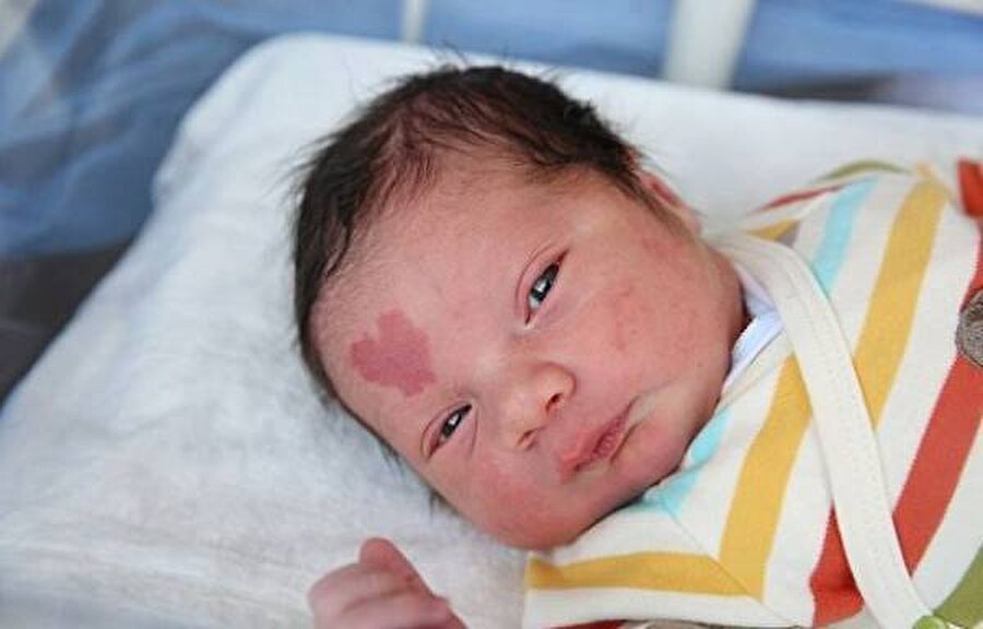 Çınar ve minik kalbiyle tanışın!
Alnında kalp şeklinde bir doğum lekesiyle doğan özel bebek Çınar'a merhaba deyin!