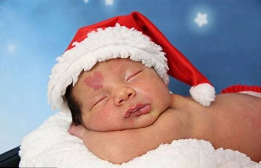 Hemşire fark etti
Doğum sonrası, hemşire Çınar bebeğin yüzünü temizlerken lekeyi fark eder.