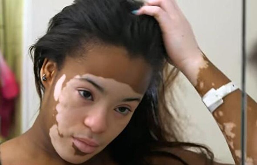 Kamera karşısında makyajını sildi 

                                    Baltimore Üniversitesi'ne gittikten sonra arkadaşlarına açılan Mariah, hastalığının sıkıntılı dönemlerini bir videoda anlattı ve kameranın karşısında makyajını sildi.
                                
