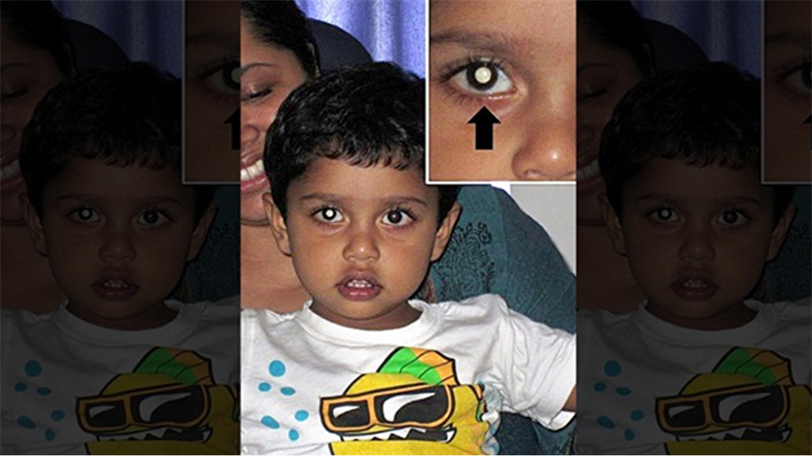 Fotoğraftaki o ayrıntı kanseri ortaya çıkardı