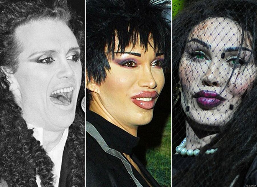 Pete Burns

                                    
                                    
                                    
                                    
                                    
                                    
                                    Ünlü şarkıcı Pete Burns, neredeyse tüm birikimini estetik operasyonlara harcadı.

                                
                                
                                
                                
                                
                                
                                