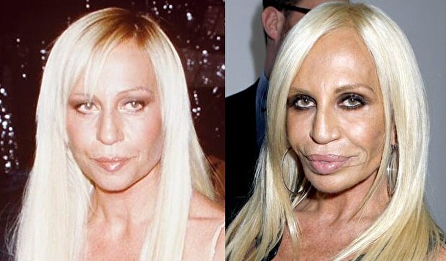 Donatella Versace

                                    
                                    
                                    
                                    
                                    
                                    
                                    Her geçirdiği  operasyonla biraz daha kötüleşen Donatella Versace, 61 yaşında.
                                
                                
                                
                                
                                
                                
                                