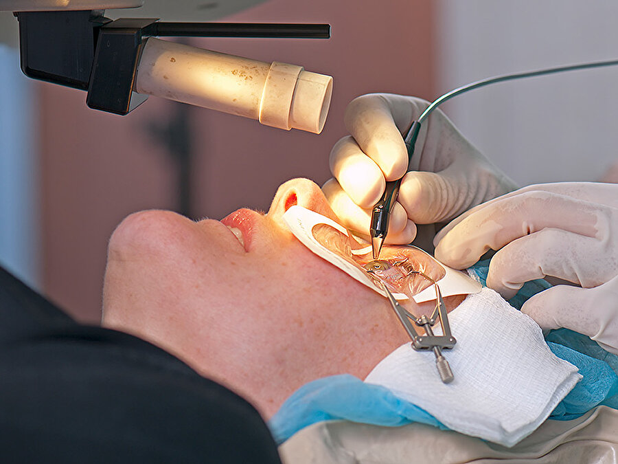 Milyonlarca kişi, lasik operasyonuyla gözlüklerinden kurtuldu.