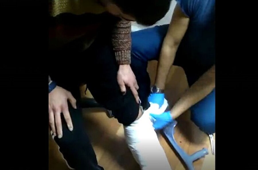 Ayağındaki alçı çıkarılınca herkes şaşkına döndü.