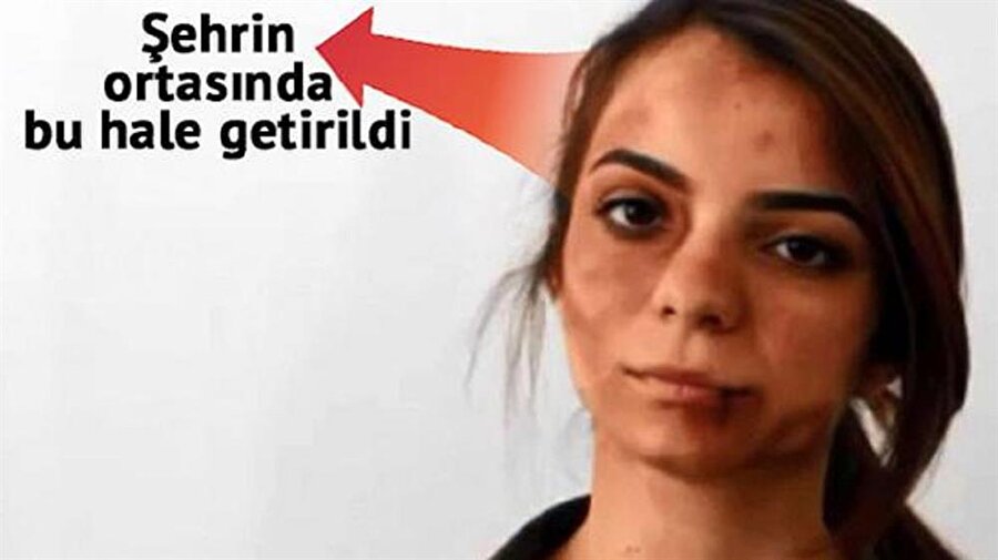 Şehrin ortasında bu hale getirildi, kimse dönüp bakmadı.