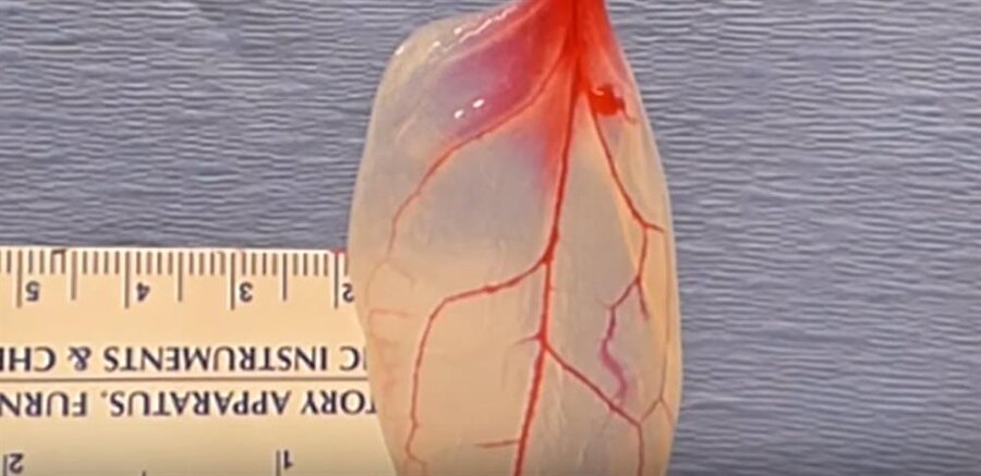 
3D yazdırma gibi teknikler kullanarak dallanma ağı oluşturmakta zorlanan doktorlar, dikkatlerini bitkilere yönelterek ve üzerinde çalıştıkları bitkileri dokuya çevirerek bunu çözdü. 