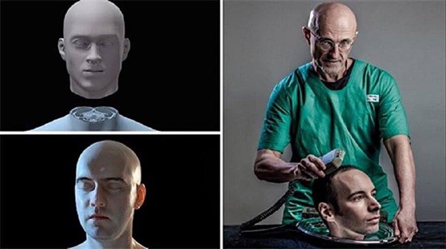 ​Şaka gibi geliyor ama gerçek: Kafa nakli için her şey hazır