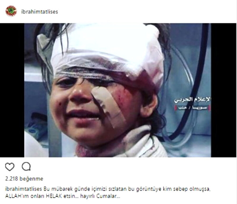 "Allah’ım onları helak etsin!"

                                    
                                    Suriye'nin Halep kentinde sivillerin tahliye edildiği sırada düzenlenen bombalı saldırıda 126 kişi hayatını kaybetti. Çocuklara çok yakın yerde düzenlenen saldırıda hayatını kaybedenlerin arasında 68 çocuğun yer aldığı açıklandı.O çocukların arasında yaralanan küçük kızın kamerayı görünce bir an yaşadıklarını unutup gülümsemesi, sosyal medyada büyük yankı buldu. Ünlü şarkıcı İbrahim Tatlıses Instagram hesabından Suriyeli kızın fotoğrafını paylaşıp altına şu notu düştü:
“Bu mübarek günde içimizi sızlatan bu görüntüye kim sebep olmuşsa, Allah’ım onları helak etsin. Hayırlı cumalar.”
                                
                                