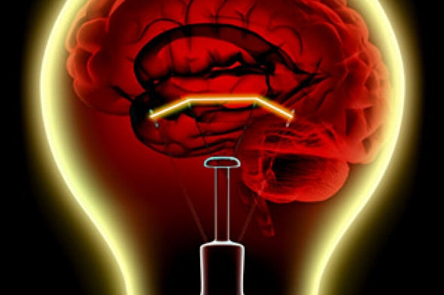 Beyinde elektriksel işlemler gerçekleşir
Beynimizde gerçekleşen olaylar elektrikseldir, nöronlar aralarında elektrik akımını iletir. Bir insan beyni, yaklaşık 25 Watt’lık bir ampulü yakacak kadar elektriklenmeye sahiptir.