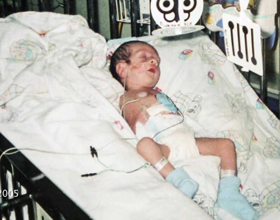 Mayıs 2005'te dünyaya gelen Timmy'nin kalp hastalığı olduğu anlaşıldı. Timmy, sekiz günlükken ciddi bir kalp ameliyatı geçirdi. 