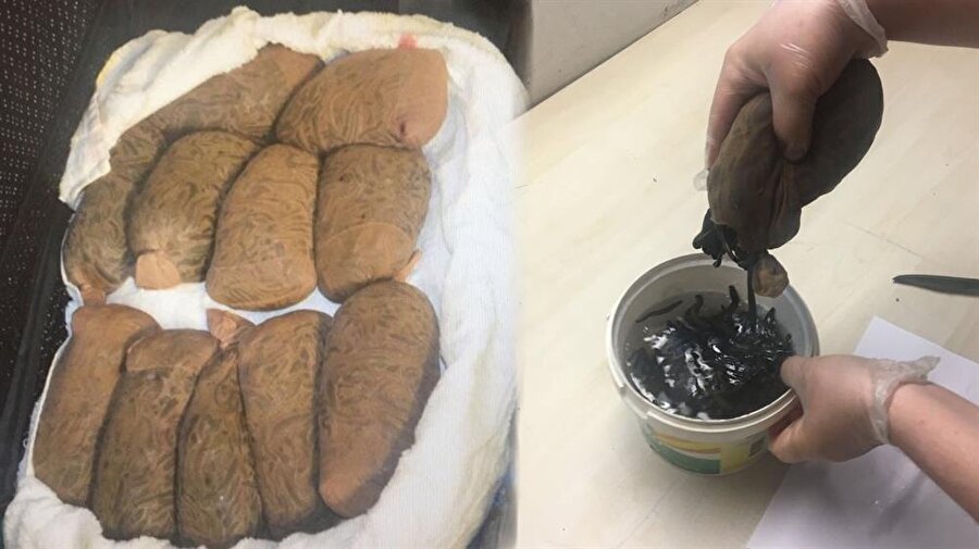 valizden sülük çıktı