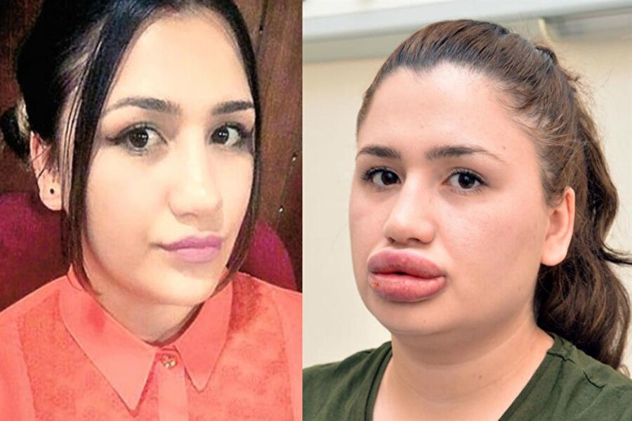 Merve hemşire