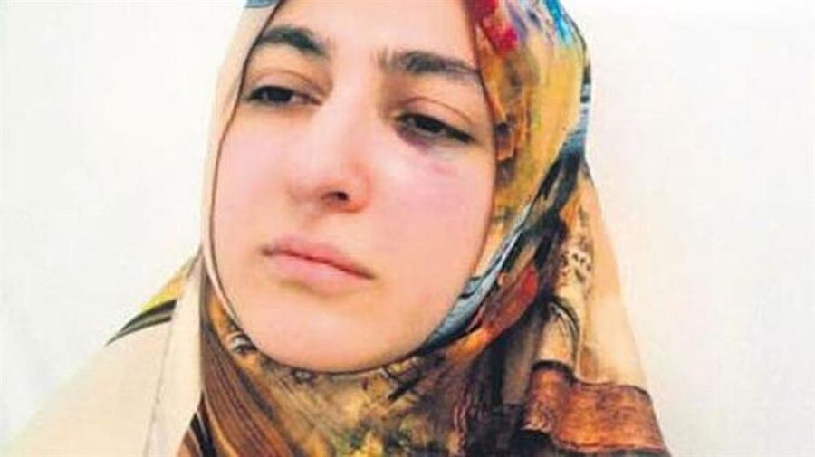 Dişçide akılalmaz olay
