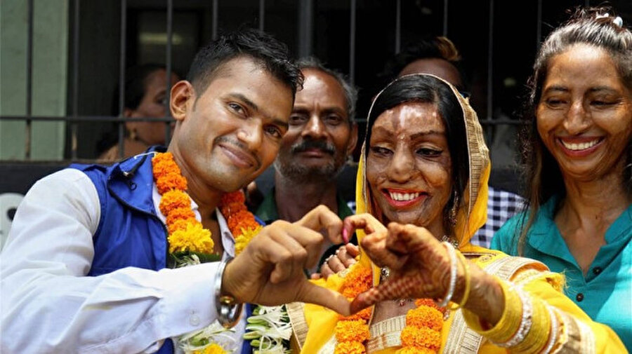 Her şey bir tesadüf

                                    
                                    Hikayesinin yerel basında duyulması üzerine, Saahas adlı sivil toplum kuruluşunun düzenlediği yardım kampanyası sayesinde yüzünden 17 kez ameliyat geçirerek hayata tutunan Bansi, hayatının aşkını da bir tesadüf eseri buldu.
                                
                                