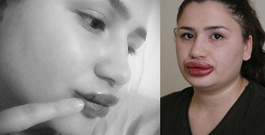 Silikon faciasında soruşturma tamamlandı