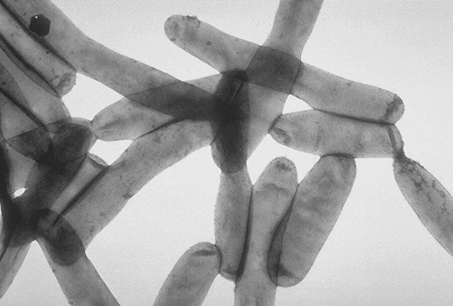 Legionella Pneumophila
Tatlı sularda sıklıkla karşılaşılan bir bakteridir. Bu bakteriye maruz kalan 10 kişiden en az biri yaşamını yitirir. 