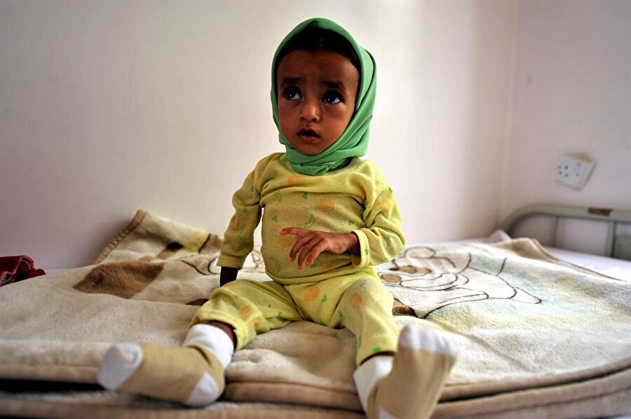 Yemen'de kolera salgını nedeniyle 27 Nisan'dan bu yana bin 742 kişinin yaşamını yitirdiği bildirildi.

                                    
                                