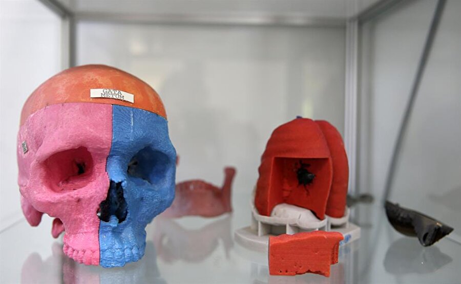 "Bütün branşlarda hizmet veriyoruz" 
Merkezde çalışan mühendislerin, hekimlerin hastaları için talep ettikleri ürünleri hastanın tomografisi üzerinden üç boyutlu hale getirdiğini aktaran METÜM Müdürü Simel Ayyıldız da, "Hekimden ne istediğini öğrendikten sonra ne tarz bir tasarım yapmamız gerekiyorsa onu tasarlıyoruz. Tasarımımızı gösteriyoruz. Hekim onay verdikten sonra da bunu elinde görebileceği hale getirip plastik çıktısını kendisine verebiliyoruz. 'Bu benim için uygundur' derse, metalden üretiyoruz ve hastaya uygulanabilir hale getiriyoruz." dedi.
Türkiye'de tedavi olan yabancı uyruklu hastalara da hizmet verdiklerini ifade eden Ayyıldız, uluslararası anlamda da talepleri karşılayabilecek durumda olduklarını söyledi. Ayyıldız, beyin cerrahi, plastik cerrahi, ortopedi, genel cerrahi, kulak, burun, boğaz, göğüs cerrahisi gibi tüm branşlara hizmet ettiklerini kaydetti.