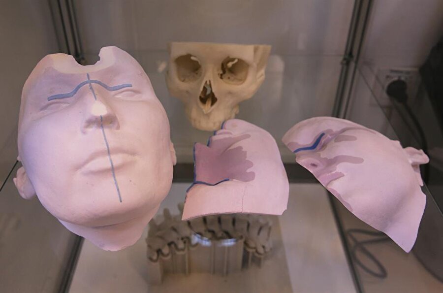 Titanyumdan vücut parçası 