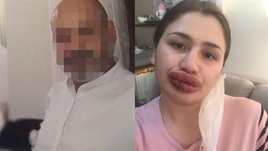 ​Sahte botoksçu Soner G. cezaevinden kaçtı.