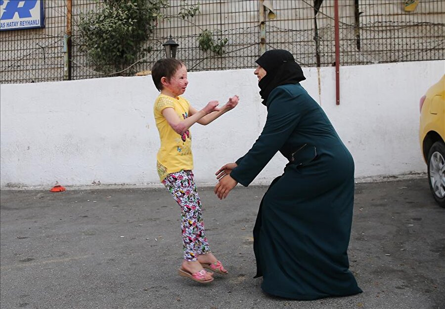 Küçük Hiba, annesi ve kardeşlerine kavuştu
Suriye'nin İdlib kentinde evlerine düşen bomba sonucu elleri ile yüzü yanan ve tedavi görmek için geldiği Türkiye'de 8 aydır anne ve kardeş hasreti çeken 8 yaşındaki Hiba Mekzum'un özlemi, Cumhurbaşkanlığı ve hayırseverlerin desteğiyle giderildi. Mekzum, annesi Diyya Kadik'i Dudullu'daki otobüs terminalinde karşıladı.