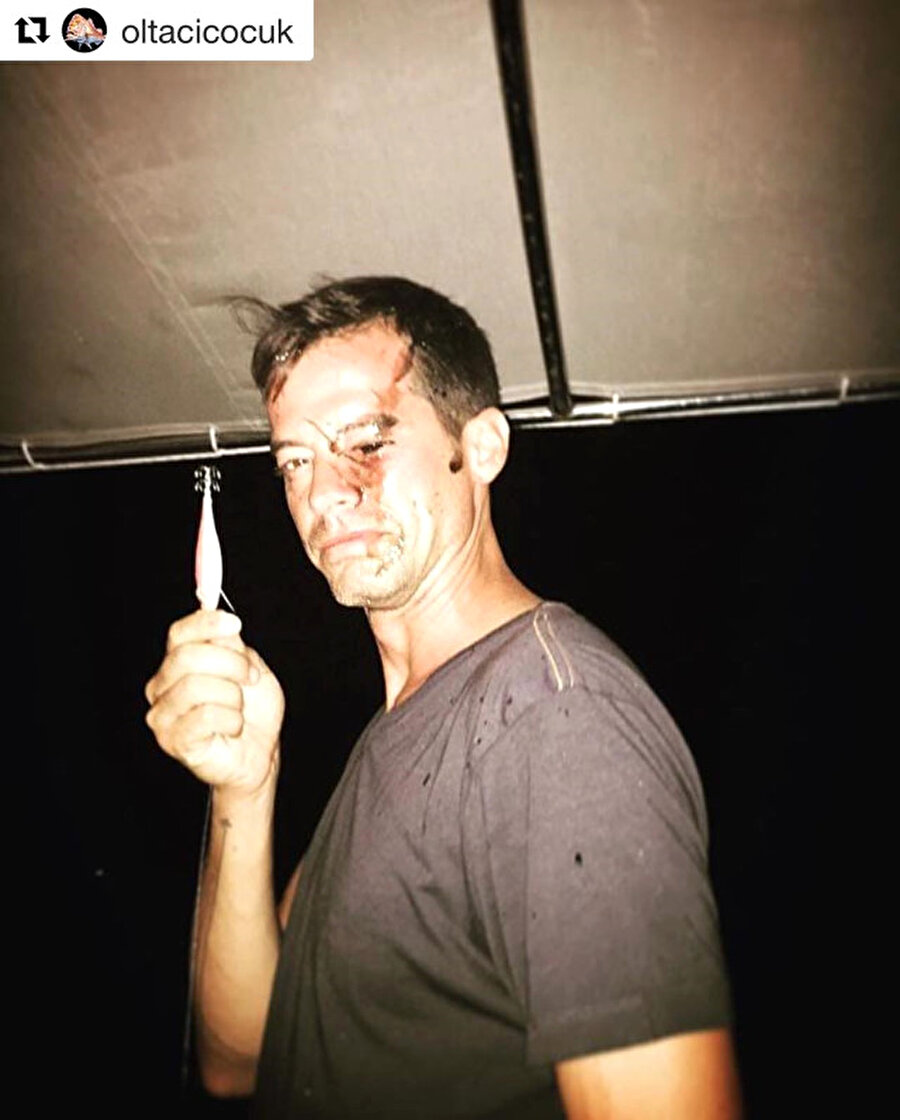 Talihsizlik!

                                    Alp Kırşan'ın paylaşımı oldukça ürkütücü görünse de, korkulacak bir şey yoktu. Küçük bir talihsizlik sonucu yüzü bu hale gelen ünlü isim, esprili bir dille sosyal medya hesabından paylaşımda bulundu. 
                                