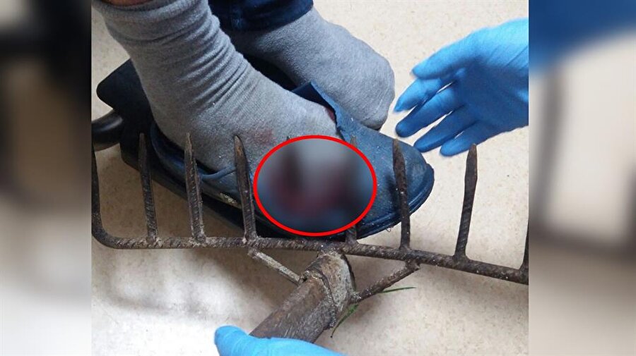 Ordu'da yaşlı adamın ayağına tırmık battı