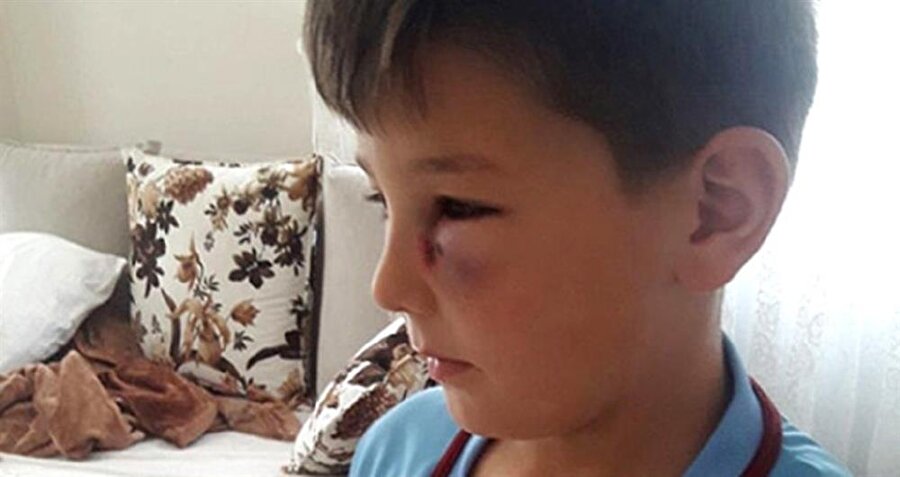 7 yaşındaki çocuğun gözüne maçta davul tokmağı geldi: "Bunu yapan insan olamaz"​