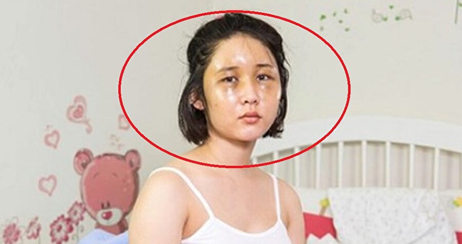 Güney Kore'de inanılmaz bir akım daha!
Güney Kore'deki estetik merkezleri işi abarttı; güzel görünmek adına yapmadıkları yok.