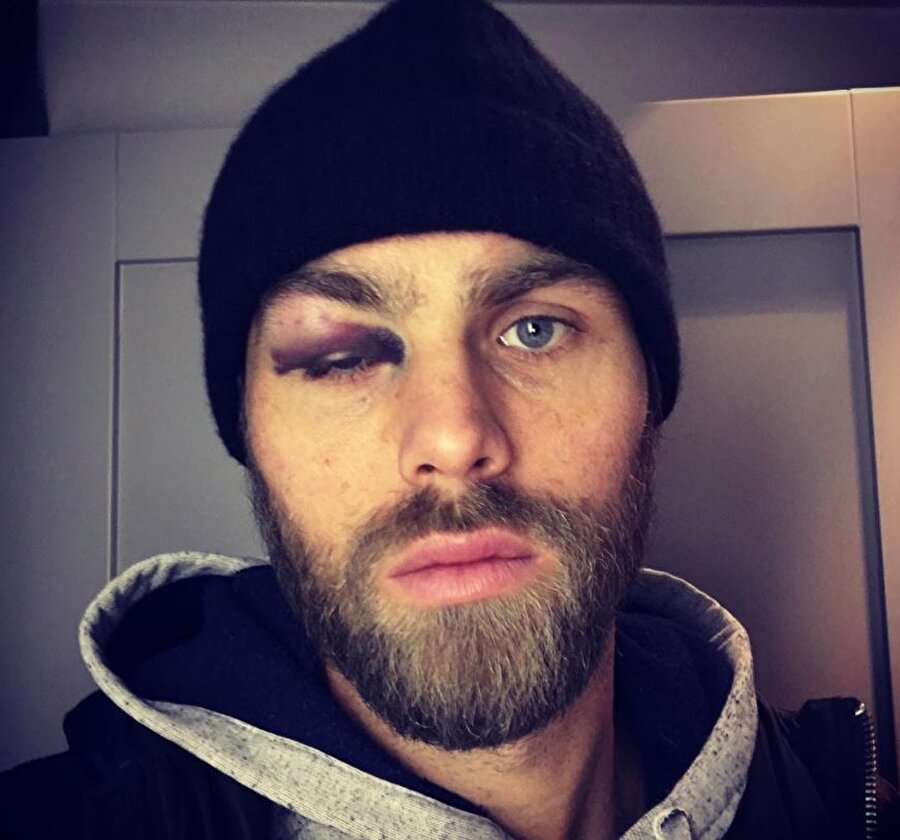 Elmander'in son hali hayranlarını şaşırttı