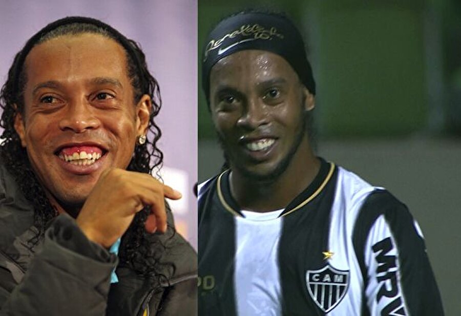 
                                    
                                    
                                    Bu arada Ronaldinho meşhur dişlerinden 2013 yılında kurtuldu. Sambacı dişlerini yaptırdıktan sonra farklı bir görüntüye sahip oldu.
                                
                                
                                