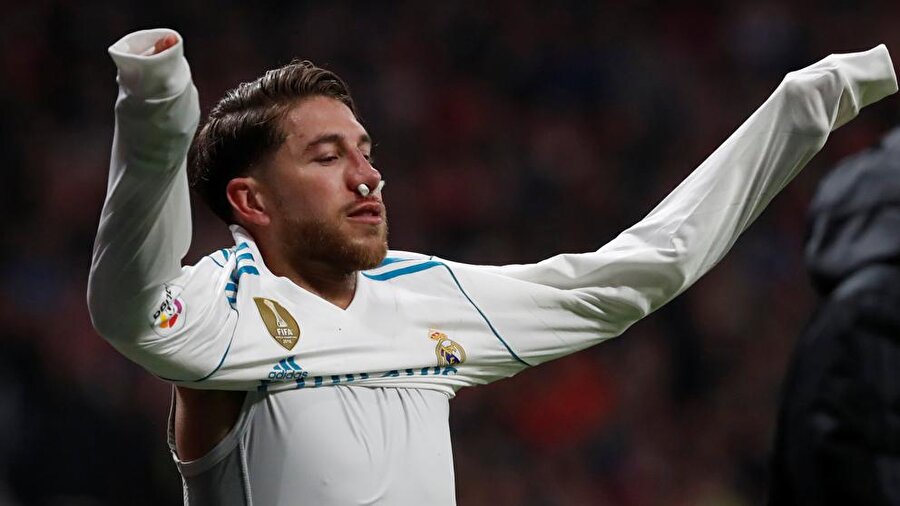 Sergio Ramos’un burnu kırıldı