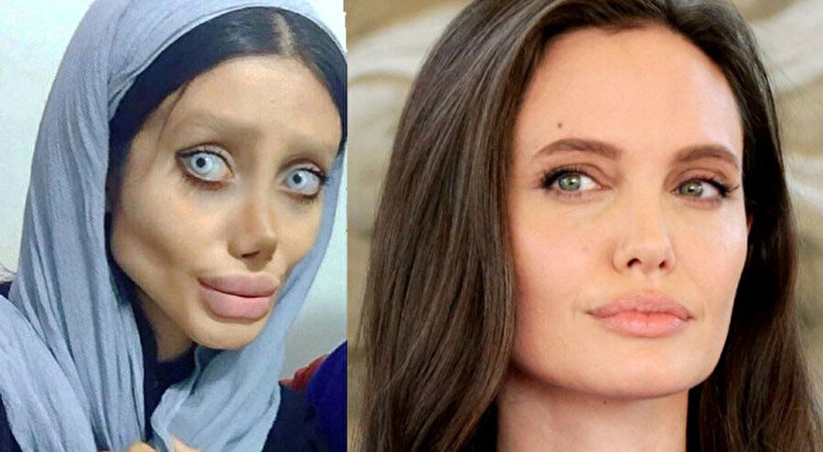 Servet harcadı!

                                    İranlı genç kız, Angelina Jolie'ye benzemek için bir servet harcadı. 
                                