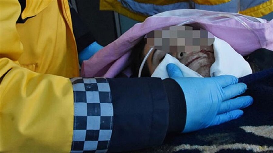 Eşini yüzünden bıçaklayan adamdan pişkin paylaşım