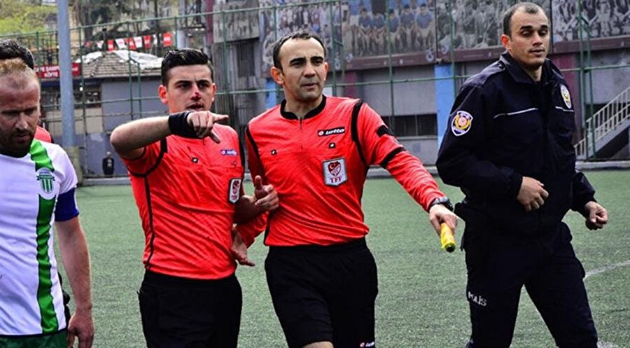 Hakemin burnunu ısırdı, 4 yıl hapis cezası aldı!