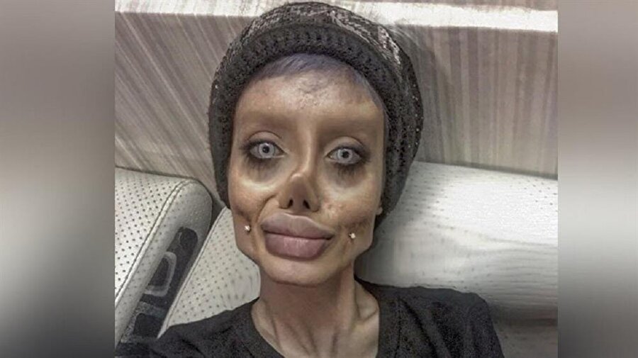 estetik faciasindan soke eden itiraf
