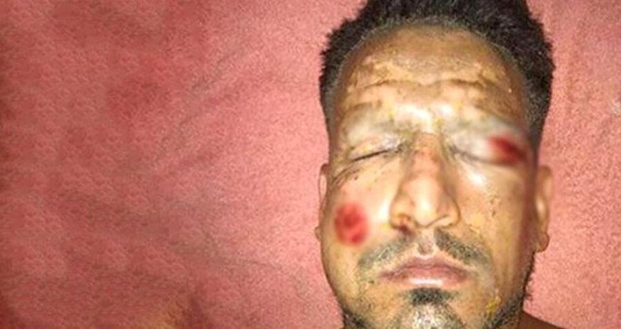 Yüzünde havai fişek patlayan Arjantinli golcü tanınmaz hale geldi