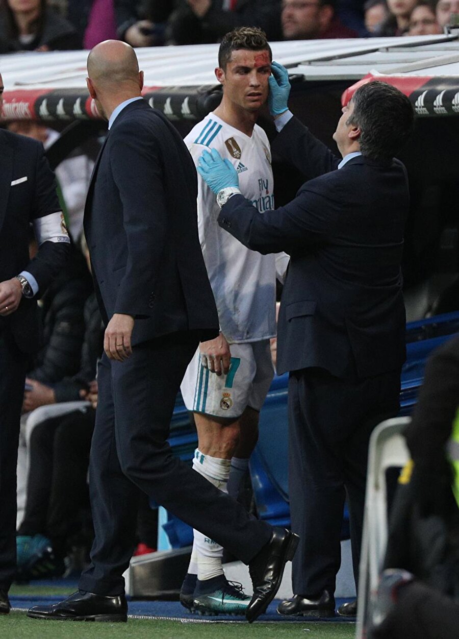 Ronaldo kanlar içinde kaldı!