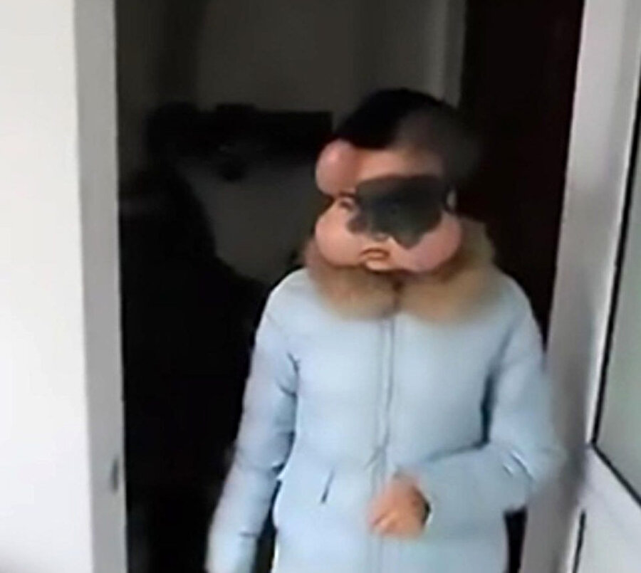 Ölümcül doğum lekesini görülmemiş bir yöntemle çıkardılar